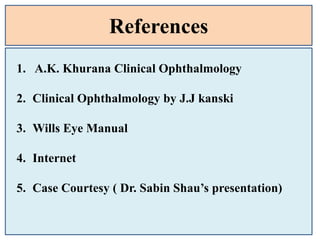 References
1. A.K. Khurana Clinical Ophthalmology
2. Clinical Ophthalmology by J.J kanski
3. Wills Eye Manual
4. Internet
5. Case Courtesy ( Dr. Sabin Shau’s presentation)
 