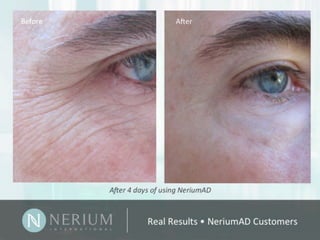 Nerium Real Results Presentation - GET $30 CUSTOMER DISCOUNT