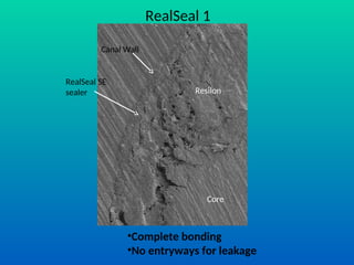 Root Filling Material: RealSeal (Resilon).ppt