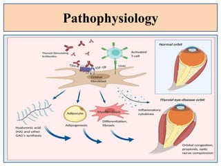 Pathophysiology
 