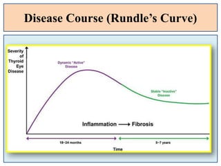 Disease Course (Rundle’s Curve)
 
