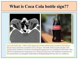 What is Coca Cola bottle sign??
 