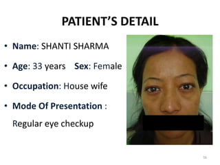 PATIENT’S DETAIL
• Name: SHANTI SHARMA
• Age: 33 years Sex: Female
• Occupation: House wife
• Mode Of Presentation :
Regular eye checkup
56
 