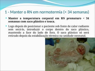 1 - Manter o RN em normotermia (< 34 semanas)
 Manter a temperatura corporal em RN prematuro < 34
semanas com saco plástico e touca.
 Logo depois de posicionar o paciente sob fonte de calor radiante
sem secá-lo, introduzir o corpo dentro do saco plástico,
mantendo a face do lado de fora. O saco plástico só será
retirado depois da estabilização térmica na unidade neonatal.
 