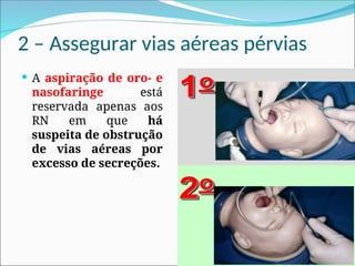 2 – Assegurar vias aéreas pérvias
 A aspiração de oro- e
nasofaringe está
reservada apenas aos
RN em que há
suspeita de obstrução
de vias aéreas por
excesso de secreções.
 