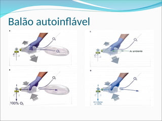 Balão autoinflável
 