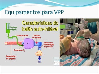 Equipamentos para VPP
 