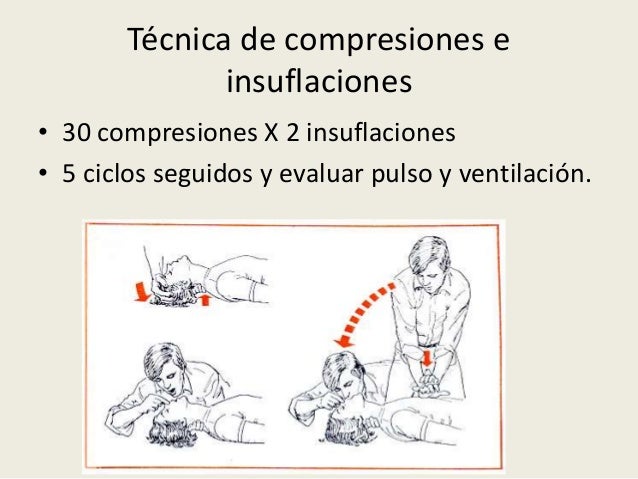 Reanimación cardiopulmonar básica