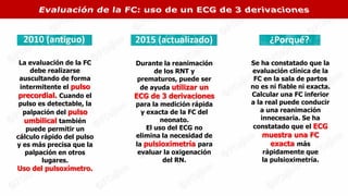Durante la reanimación
de los RNT y
prematuros, puede ser
de ayuda utilizar un
ECG de 3 derivaciones
para la medición rápida
y exacta de la FC del
neonato.
El uso del ECG no
elimina la necesidad de
la pulsioximetría para
evaluar la oxigenación
del RN.
Se ha constatado que la
evaluación clínica de la
FC en la sala de partos
no es ni fiable ni exacta.
Calcular una FC inferior
a la real puede conducir
a una reanimación
innecesaria. Se ha
constatado que el ECG
muestra una FC
exacta más
rápidamente que
la pulsioximetría.
La evaluación de la FC
debe realizarse
auscultando de forma
intermitente el pulso
precordial. Cuando el
pulso es detectable, la
palpación del pulso
umbilical también
puede permitir un
cálculo rápido del pulso
y es más precisa que la
palpación en otros
lugares.
Uso del pulsoxímetro.
 