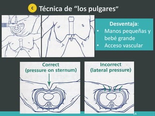 Técnica de “los pulgares”
Desventaja:
• Manos pequeñas y
bebé grande
• Acceso vascular
14
C
 