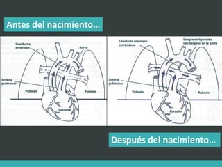 Antes del nacimiento…
Después del nacimiento…
 