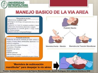 Trauma. Sociedad Panamericana de Trauma. Ricardo Ferrada , Aurelio Rodríguez. Ed 2. editorial DIstribuna 2009
“Maniobra de subluxación
mandibular” para despejar la vía aérea
 