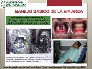 Trauma. Sociedad Panamericana de Trauma. Ricardo Ferrada , Aurelio Rodríguez. Ed 2. editorial DIstribuna 2009
Acontecimientos anatómicos y
fisiológicos que pueden incrementar
la dificultad de ventilar a un paciente
 