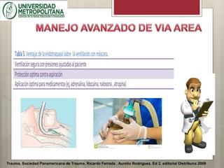 Trauma. Sociedad Panamericana de Trauma. Ricardo Ferrada , Aurelio Rodríguez. Ed 2. editorial DIstribuna 2009
Tabla5.Ventajasdelaendotraquealsobre laventilaciónconmáscara.
Ventilaciónseguraconpresionesajustadasalpaciente
Protecciónoptimacontraaspiración
Aplicaciónóptimaparamedicamentos(ej,adrenalina,lidocaína,naloxona,atropina)
 
