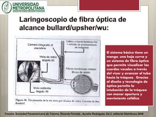 Trauma. Sociedad Panamericana de Trauma. Ricardo Ferrada , Aurelio Rodríguez. Ed 2. editorial DIstribuna 2009
El sistema básico tiene un
mango, una hoja curva y
un sistema de fibra óptica
que permite visualizar las
cuerdas vocales a través
del visor y avanzar el tubo
hacia la tráquea . Gracias
al diseño y tecnología de
óptica permite la
intubación de la tráquea
con menor apertura y
movimiento cefálico.
 