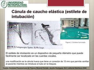 Trauma. Sociedad Panamericana de Trauma. Ricardo Ferrada , Aurelio Rodríguez. Ed 2. editorial DIstribuna 2009
El estilete de intubación es un dispositivo de pequeño diámetro que puede
fácilmente ser localizado en las cuerdas vocales.
una modificación es la cánula hueca que tiene un conector de 15 mm que permite ventilar
al paciente mientras se introduce el tubo en la tráquea.
 