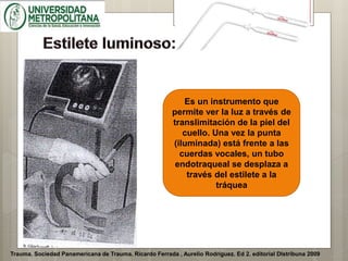 Trauma. Sociedad Panamericana de Trauma. Ricardo Ferrada , Aurelio Rodríguez. Ed 2. editorial DIstribuna 2009
Es un instrumento que
permite ver la luz a través de
translimitación de la piel del
cuello. Una vez la punta
(iluminada) está frente a las
cuerdas vocales, un tubo
endotraqueal se desplaza a
través del estilete a la
tráquea
 