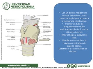 • Con un bisturí, realizar una
incisión vertical de 1 cm a
través de la piel para acceder a
la membrana cricotiroidea.
• Insertar un tubo de
traqueostomía o tubo
endotraqueal de 6 o 7 mm de
diámetro interno.
• Inflar el balón y asegurar el
tubo.
• Ventilar con un ambú a la
mayor concentración de
oxígeno posible.
Determinar si la ventilación es
efectiva.
Trauma. Sociedad Panamericana de Trauma. Ricardo Ferrada , Aurelio Rodríguez. Ed 2. editorial DIstribuna 2009
 
