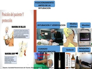 POSICIONAMIENTO
ANTES DE LA
INTUBACION
INTUBACION Y VERIFICACION
CUIDADO
POSTINTUBACION
Medios
clínicos
Monitor
eo
Sedació
n
Relajación
neuromusc
ularFijación del
tubo
Trauma. Sociedad Panamericana de Trauma. Ricardo Ferrada , Aurelio Rodríguez. Ed 2. editorial DIstribuna 2009
 
