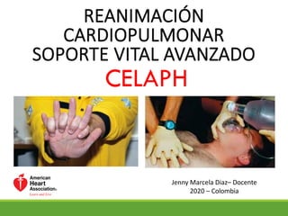 REANIMACIÓN
CARDIOPULMONAR
SOPORTE VITAL AVANZADO
CELAPH
Jenny Marcela Diaz– Docente
2020 – Colombia
 