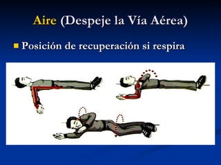 Posición de recuperación si respira Aire  (Despeje la Vía Aérea) 