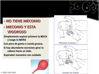 3.- Despejar la via aerea    ...si es necesario - NO TIENE MECONIO  - MECONIO Y ESTA VIGOROSO  Simplemente aspirar primero la  B OCA y luego la  N ARIZ Con pera de goma o sonda gruesa. Si hay abundante secrecion girar la cabeza hacia un lado. Aspirador mecanico con cuidado © 2005 AAP/AHA 