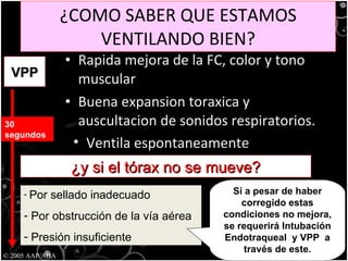 ¿COMO SABER QUE ESTAMOS VENTILANDO BIEN? Rapida mejora de la FC, color y tono muscular Buena expansion toraxica y auscultacion de sonidos respiratorios.  © 2005 AAP/AHA VPP 30 segundos Ventila espontaneamente ¿y si el tórax no se mueve? Por sellado inadecuado Por obstrucción de la vía aérea Presión insuficiente Si a pesar de haber corregido estas condiciones no mejora, se requerirá Intubación Endotraqueal  y VPP  a través de este. 