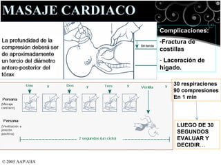 © 2005 AAP/AHA MASAJE CARDIACO Complicaciones: Fractura de costillas Laceración de hígado. 30 respiraciones 90 compresiones En 1 min LUEGO DE 30 SEGUNDOS  EVALUAR Y DECIDIR … 