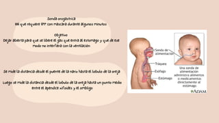Sonda orogastrica
RN que requiere VPP con mascara durante algunos minutos
Objetivo
Dejar abierta para que se libere el gas que entra al estomago y que de ese
modo no interfiera con la ventilación
Se mide la distancia desde el puente de la nariz hasta el lobulo de la oreja
Luego se mide la distancia desde el lobulo de la oreja hasta un punto medio
entre el apendice xifoides y el ombligo
 