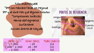 Tubo endotraqueal
*VPP con mascara facial sin mejorua
VPP que dura mas que algunos minutos
*Compresiones torácicas
Hernia diafragmatica
Surfactante
Succión directa de traquea
 