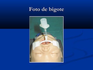 FFoottoo ddee bbiiggoottee 
 