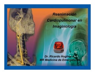 Reanimación
    Cardiopulmonar en
        Imaginología




   Dr. Ricardo Hughes A.
MR Medicina de Emergencias
 