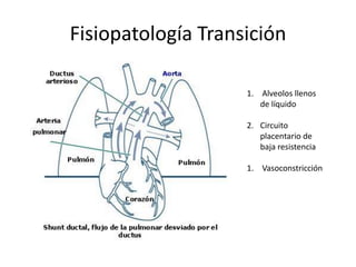 Fisiopatología Transición Alveolos llenos de líquidoCircuito placentario de baja resistencia Vasoconstricción