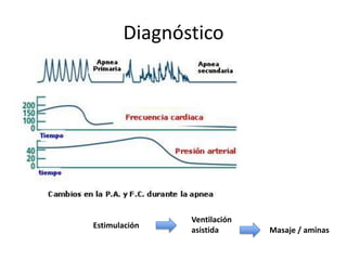 Diagnóstico Ventilación asistidaEstimulaciónMasaje / aminas