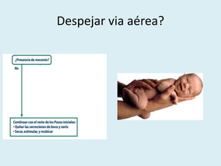 Despejar via aérea?
 