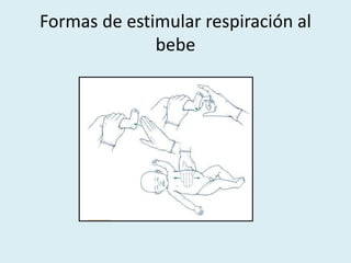 Formas de estimular respiración al
bebe
 