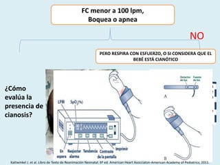 FC menor a 100 lpm,
Boquea o apnea
NO
PERO RESPIRA CON ESFUERZO, O SI CONSIDERA QUE EL
BEBÉ ESTÁ CIANÓTICO
• Sólo la cianosis central debería ser un
signo que sugiera un bajo nivel de
oxigenación de la sangre que podría
requerir una intervención.
• Para confirmar la cianosis percibida
debe usarse un oxímetro.
¿Cómo
evalúa la
presencia de
cianosis?
Kattwinkel J. et al. Libro de Texto de Reanimación Neonatal. 6º ed. American Heart Asocciaton-American Academy of Pediatrics; 2011.
 