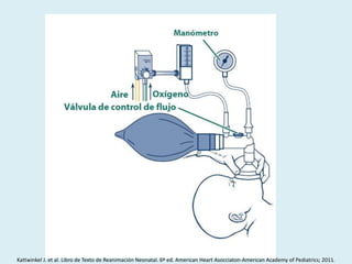 Kattwinkel J. et al. Libro de Texto de Reanimación Neonatal. 6º ed. American Heart Asocciaton-American Academy of Pediatrics; 2011.
 