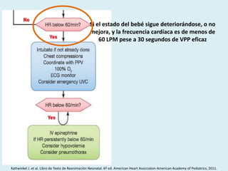 Si el estado del bebé sigue deteriorándose, o no
mejora, y la frecuencia cardíaca es de menos de
60 LPM pese a 30 segundos de VPP eficaz
Kattwinkel J. et al. Libro de Texto de Reanimación Neonatal. 6º ed. American Heart Asocciaton-American Academy of Pediatrics; 2011.
 