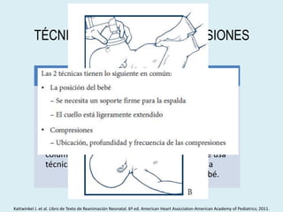 TÉCNICAS PARA LAS COMPRESIONES
La técnica del pulgar
• En la que se usan los
2 pulgares para
deprimir el esternón,
mientras las manos
rodean el torso y los
dedos sostienen la
columna. Esta es la
técnica preferida.
La técnica de 2 dedos
• En la que se usan las
puntas del dedo
mayor y del índice o
el anular de una
mano para comprimir
el esternón, mientras
la otra mano se usa
para sostener la
espalda del bebé.
Kattwinkel J. et al. Libro de Texto de Reanimación Neonatal. 6º ed. American Heart Asocciaton-American Academy of Pediatrics; 2011.
 