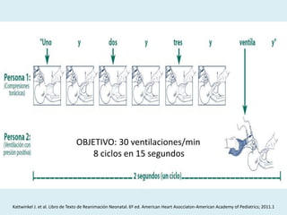 Kattwinkel J. et al. Libro de Texto de Reanimación Neonatal. 6º ed. American Heart Asocciaton-American Academy of Pediatrics; 2011.1
OBJETIVO: 30 ventilaciones/min
8 ciclos en 15 segundos
 