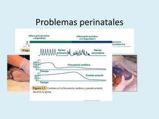 Problemas perinatales
 