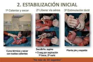 Decúbito supino
< 5 seg por aspiración
1º boca, 2º nariz
3º Estimulación táctil
1º Calentar y secar 2º Liberar vía aérea
Planta pie y espalda
2. ESTABILIZACIÓN INICIAL
Cuna térmica y secar
con toallas calientes
“No más de 30 segundos”
 