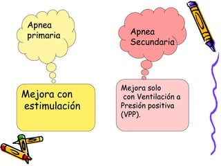 Mejora con
estimulación
Mejora solo
con Ventilación a
Presión positiva
(VPP).
Apnea
primaria Apnea
Secundaria
 