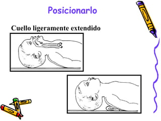 Posicionarlo
Cuello ligeramente extendido
 