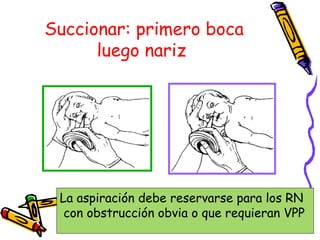 Succionar: primero boca
luego nariz
La aspiración debe reservarse para los RN
con obstrucción obvia o que requieran VPP
 