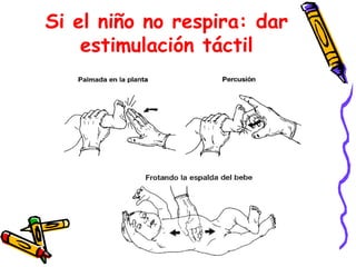 Si el niño no respira: dar
estimulación táctil
 