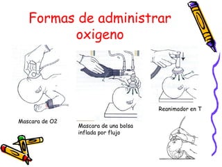 Formas de administrar
oxigeno
Mascara de O2
Mascara de una bolsa
inflada por flujo
Reanimador en T
 