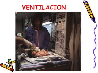 VENTILACION
 