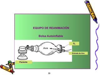 O2
Paciente
Entrada de Aire
EQUIPO DE REANIMACIÓN
33
Bolsa Autoinflable
 